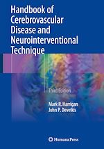 Télécharger le livre :  Handbook of Cerebrovascular Disease and Neurointerventional Technique