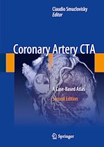 Télécharger le livre :  Coronary Artery CTA