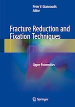 Télécharger le livre :  Fracture Reduction and Fixation Techniques