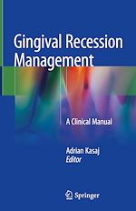 Télécharger le livre :  Gingival Recession Management