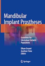 Télécharger le livre :  Mandibular Implant Prostheses