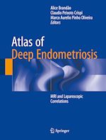 Télécharger le livre :  Atlas of Deep Endometriosis