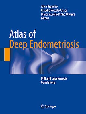 Téléchargez le livre :  Atlas of Deep Endometriosis