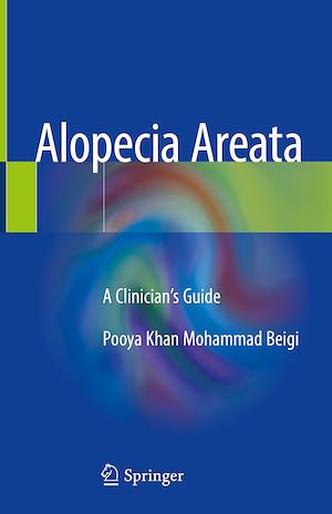 Téléchargez le livre :  Alopecia Areata