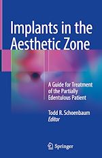 Télécharger le livre :  Implants in the Aesthetic Zone