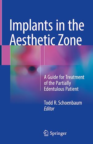 Téléchargez le livre :  Implants in the Aesthetic Zone