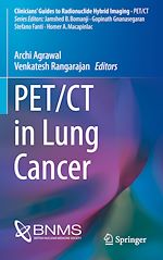 Télécharger le livre :  PET/CT in Lung Cancer