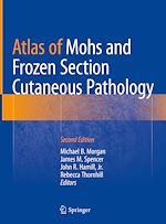 Télécharger le livre :  Atlas of Mohs and Frozen Section Cutaneous Pathology
