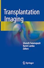 Télécharger le livre :  Transplantation Imaging