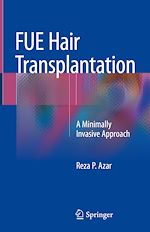 Télécharger le livre :  FUE Hair Transplantation