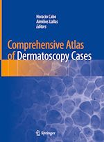 Télécharger le livre :  Comprehensive Atlas of Dermatoscopy Cases