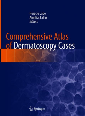Téléchargez le livre :  Comprehensive Atlas of Dermatoscopy Cases