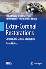 Télécharger le livre :  Extra-Coronal Restorations