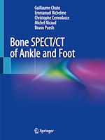 Télécharger le livre :  Bone SPECT/CT of Ankle and Foot