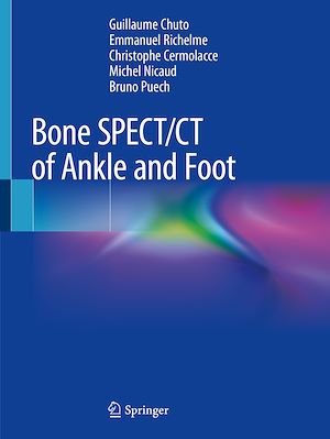Téléchargez le livre :  Bone SPECT/CT of Ankle and Foot