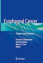 Télécharger le livre :  Esophageal Cancer