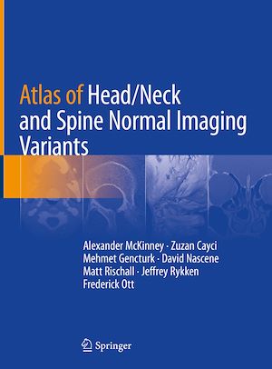 Téléchargez le livre :  Atlas of Head/Neck and Spine Normal Imaging Variants