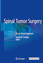 Télécharger le livre :  Spinal Tumor Surgery