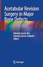 Télécharger le livre :  Acetabular Revision Surgery in Major Bone Defects