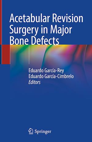 Téléchargez le livre :  Acetabular Revision Surgery in Major Bone Defects