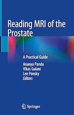 Télécharger le livre :  Reading MRI of the Prostate