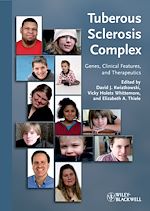 Télécharger le livre :  Tuberous Sclerosis Complex