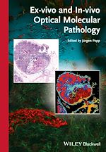 Télécharger le livre :  Ex-vivo and In-vivo Optical Molecular Pathology