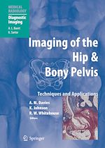 Télécharger le livre :  Imaging of the Hip & Bony Pelvis
