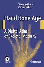 Télécharger le livre :  Hand Bone Age
