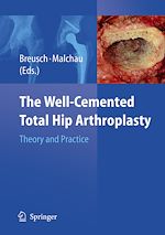 Télécharger le livre :  The Well-Cemented Total Hip Arthroplasty