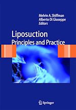 Télécharger le livre :  Liposuction