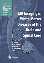 Télécharger le livre :  MR Imaging in White Matter Diseases of the Brain and Spinal Cord
