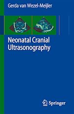 Télécharger le livre :  Neonatal Cranial Ultrasonography