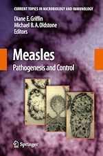 Télécharger le livre :  Measles