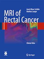 Télécharger le livre :  MRI of Rectal Cancer