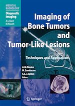 Télécharger le livre :  Imaging of Bone Tumors and Tumor-Like Lesions