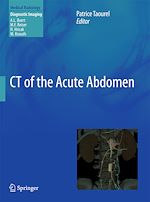 Télécharger le livre :  CT of the Acute Abdomen