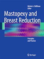 Télécharger le livre :  Mastopexy and Breast Reduction