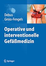 Télécharger le livre :  Operative und interventionelle Gefäßmedizin