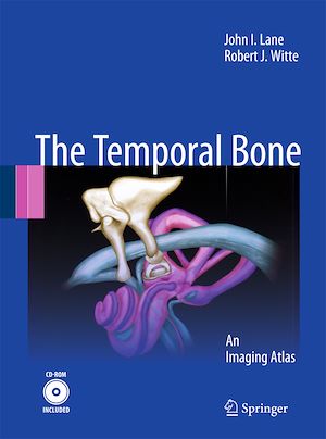 Téléchargez le livre :  Temporal Bone