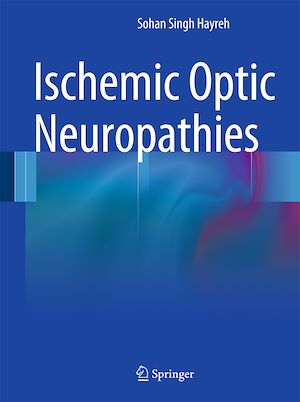 Téléchargez le livre :  Ischemic Optic Neuropathies