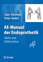 Télécharger le livre :  AE-Manual der Endoprothetik