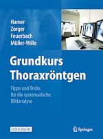 Télécharger le livre :  Grundkurs Thoraxröntgen