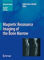 Download this eBook Magnetic Resonance Imaging of the Bone Marrow