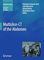 Télécharger le livre :  Multislice-CT of the Abdomen