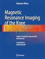 Télécharger le livre :  Magnetic Resonance Imaging of the Knee