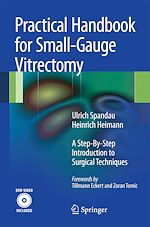 Télécharger le livre :  Practical Handbook for Small-Gauge Vitrectomy