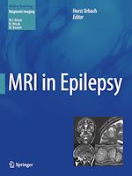 Download this eBook MRI in Epilepsy