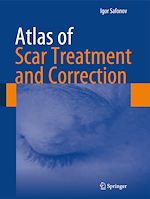 Télécharger le livre :  Atlas of Scar Treatment and Correction