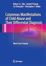 Télécharger le livre :  Cutaneous Manifestations of Child Abuse and Their Differential Diagnosis